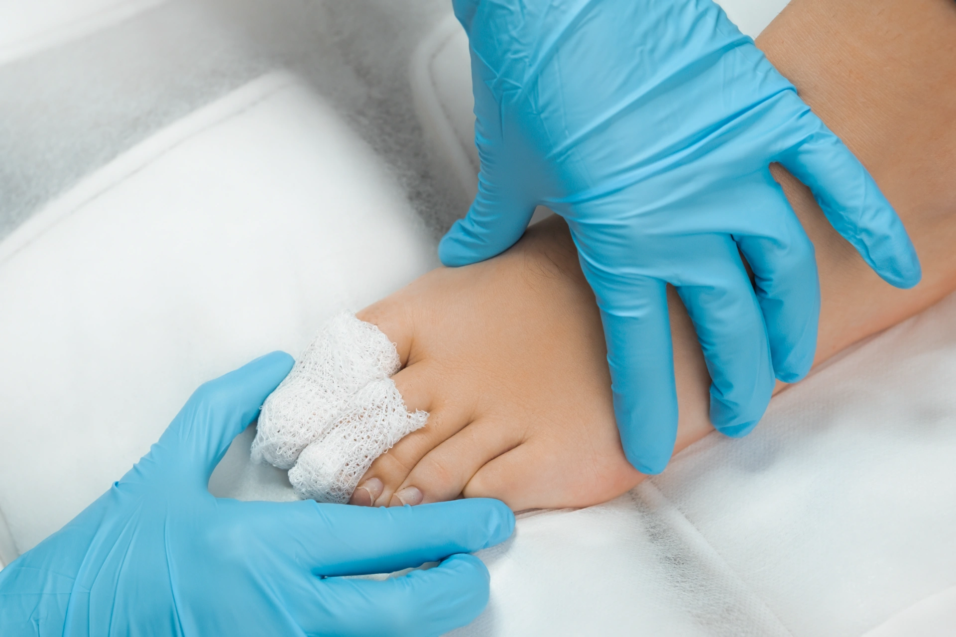 close up bandaged toes of a patient after podiatri 2024 07 29 21 20 18 utc